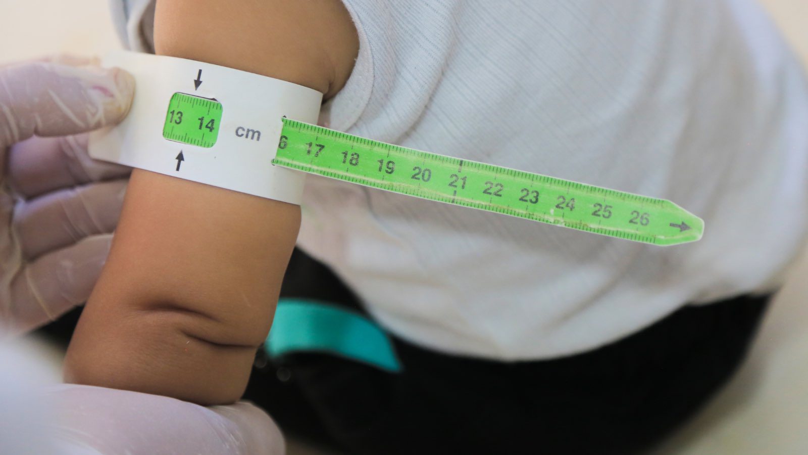 Read more about the article Climate Change Is Deepening Asia’s Child Malnutrition Crisis, UNICEF Warns
