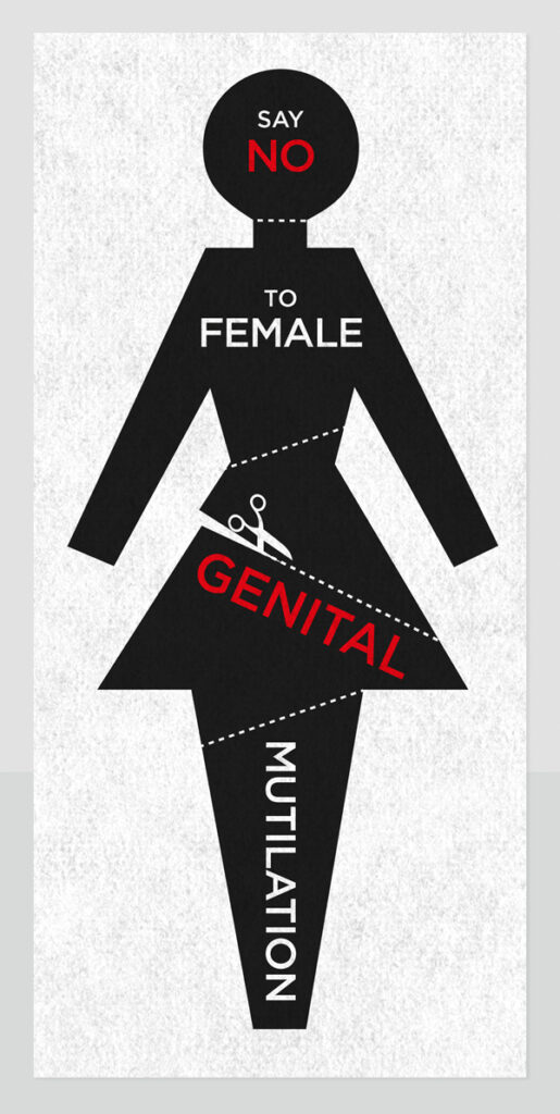 fgm